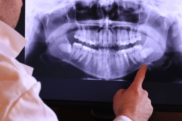 Best Emergency Denture Repair in Seven Fields, PA