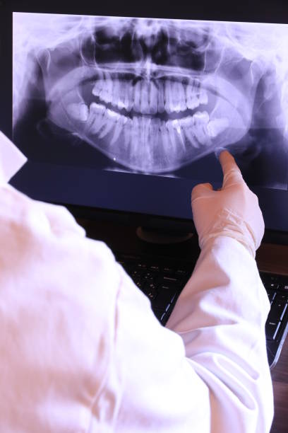 Best Emergency Denture Repair in Seven Fields, PA