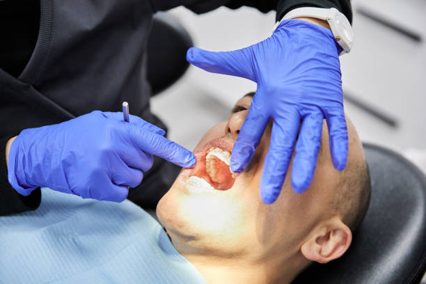 Best Emergency Dental Care for Broken or Chipped Teeth in Seven Fields, PA